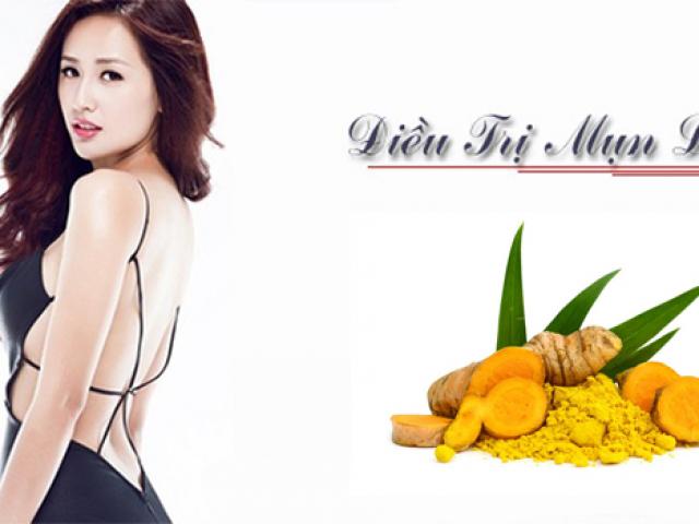 10 Cách trị mụn lưng thâm tại nhà an toàn hiệu quả nhanh nhất