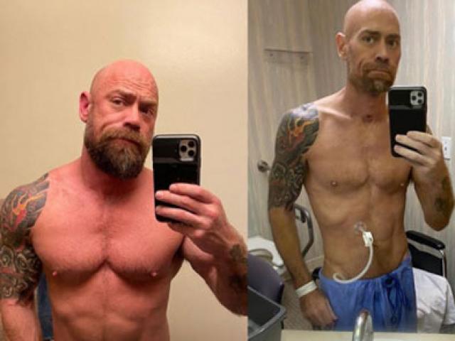 Thể thao - Y tá cơ bắp như lực sĩ "teo tóp" đến đáng sợ sau khi chữa khỏi Covid-19