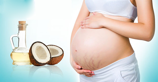 Cách trị rạn da an toàn hiệu quả nhanh nhất tại nhà - 2