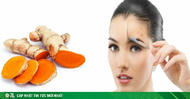 Cách trị sẹo thâm ở mặt nhanh nhất tại nhà từ nguyên liệu tự nhiên