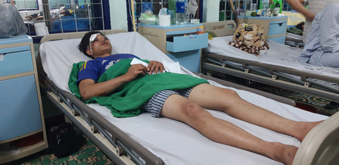  A Thiêng với chi chít vết thương trên cơ thể đau đớn nhớ lại giây phút kinh hoàng.
