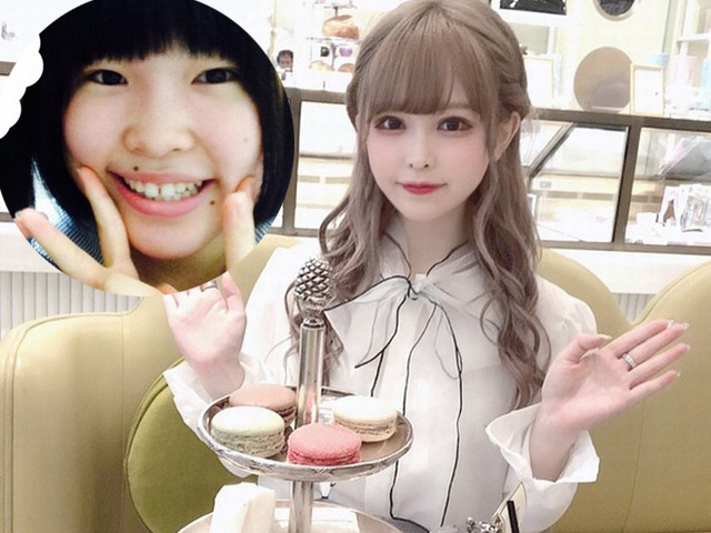 Bạn trẻ - Cuộc sống - Bị bạn trai chê "nhìn mắc ói", cô gái thực hiện 10 cuộc phẫu thuật để trở nên xinh đẹp tuyệt trần