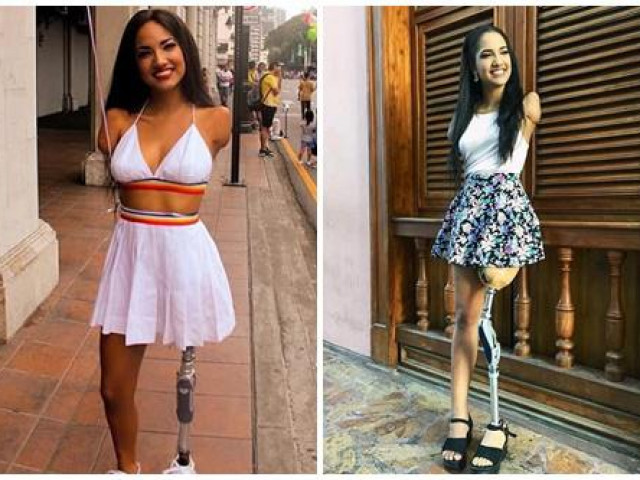 Bạn trẻ - Cuộc sống - Cô gái bị mất 3 chi nhưng làm mọi thứ chỉ bằng “chiếc chân ma thuật”, ai cũng phải "mắt chữ A, mồm chữ O" nể phục