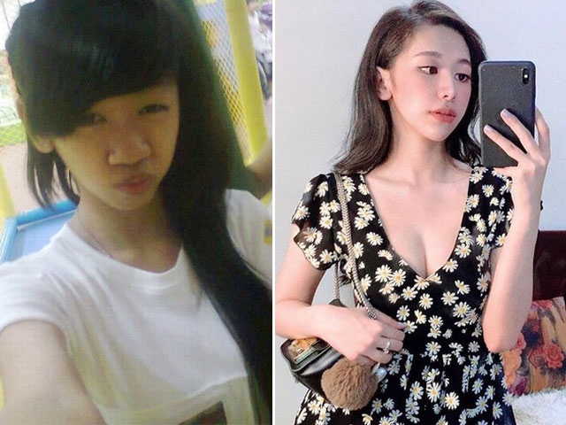 Bạn trẻ - Cuộc sống - Chia tay mối tình năm 17 tuổi vì xấu xí, cô gái tân trang nhan sắc thành hot girl