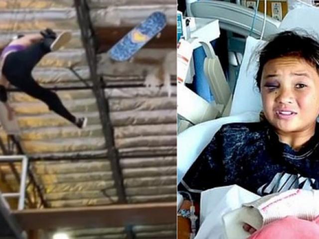 Thể thao - Nữ VĐV 11 tuổi rơi tự do ở độ cao 4m, chấn thương đáng sợ