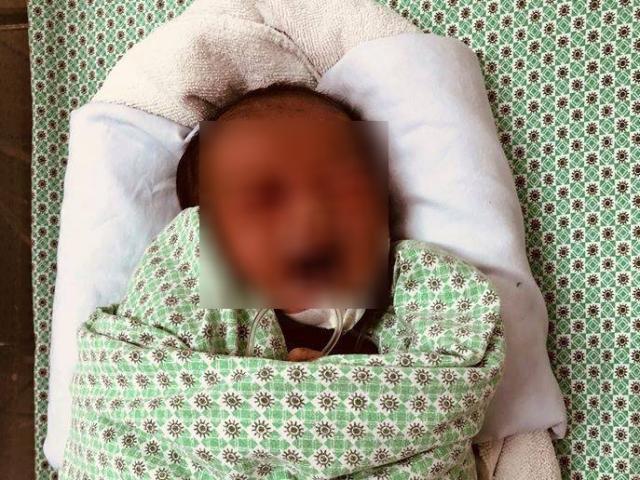 Bệnh viện Xanh Pôn thông tin về sức khoẻ bé sơ sinh bị bỏ rơi dưới hố ga 3 ngày