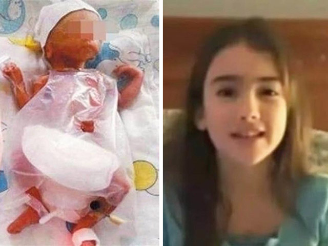 Sức khỏe đời sống - Bất ngờ trước hình ảnh 14 năm sau của cô bé nhỏ nhất TG chỉ nặng 260gr