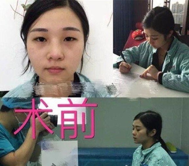 Phạm Băng Băng vẫn là hình mẫu phẫu thuật thẩm mỹ của nữ giới Trung Quốc - 3