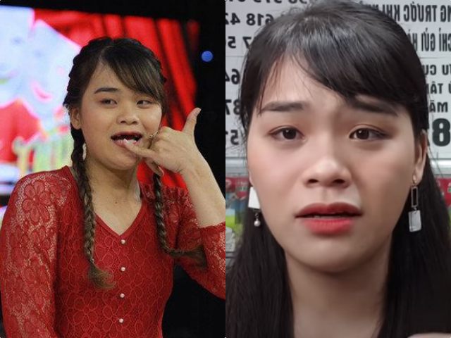 Sao Việt - "Thánh sún" được Ngô Kiến Huy tài trợ làm răng bị chỉ trích gian xảo, chảnh chọe: Sự thật bất ngờ