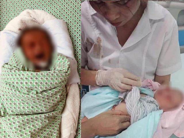 Sức khỏe bé sơ sinh bị bỏ rơi dưới hố ga có tiến triển khả quan