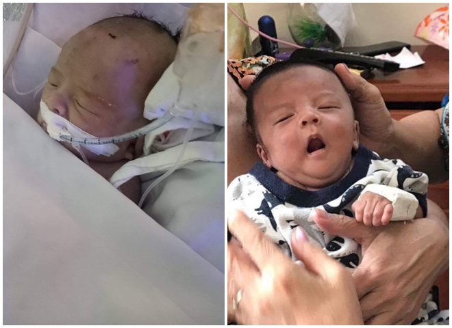 Mẹ Sài Gòn sinh con bác sĩ dặn "chuẩn bị tâm lý", 3  năm sau nhìn mặt mới ngỡ ngàng - 2