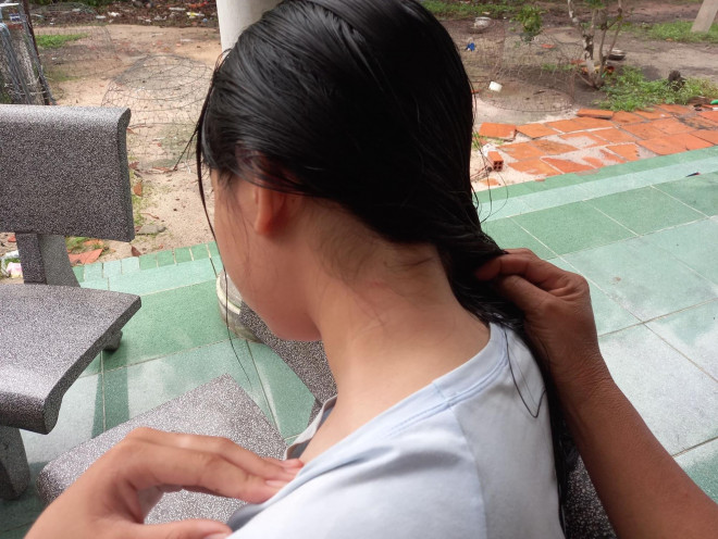 Nữ sinh Đ.T.H.N bị đánh với nhiều vết thương trên người