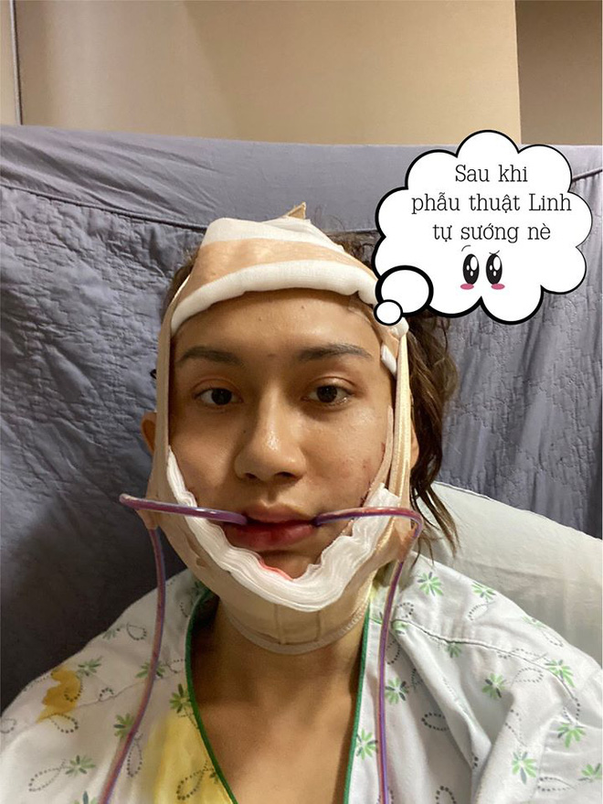 Lynk Lee tiết lộ hình ảnh phẫu thuật thẩm mỹ gây sốc - 5