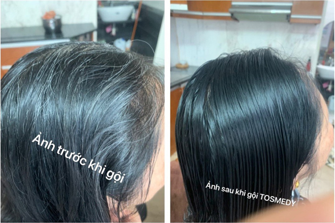 Muốn chuyển tóc bạc thành màu đen tự nhiên mà không phải nhuộm tóc? Hãy trải nghiệm dầu gội thảo dược An Giang đặc biệt, giúp tóc trở nên mềm mượt và chuyển màu một cách tự nhiên, không gây hại cho tóc.