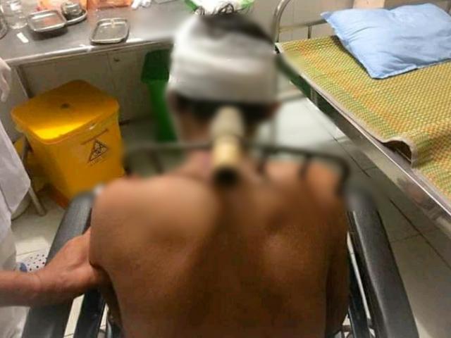 Pháp luật - Con bổ bồ cào sắt vào vai bố chỉ vì... chưa có cơm ăn