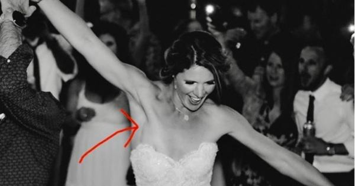 Bạn trẻ - Cuộc sống - Cô dâu bất ngờ phát hiện bị ung thư nhờ bức ảnh đám cưới