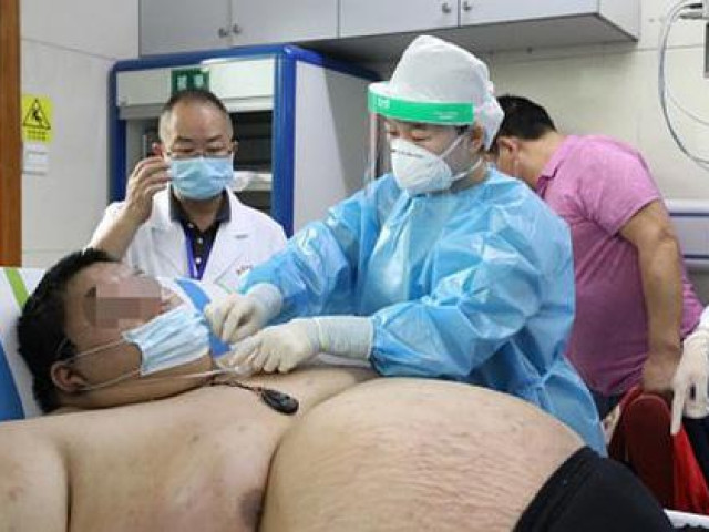 Sức khỏe đời sống - Thanh niên Trung Quốc cấp cứu do tăng 100 kg trong 5 tháng trốn dịch