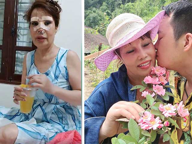 Bạn trẻ - Cuộc sống - Diện mạo khác lạ của cô dâu 62 tuổi sau hàng loạt ca tân trang nhan sắc HOT nhất tuần qua