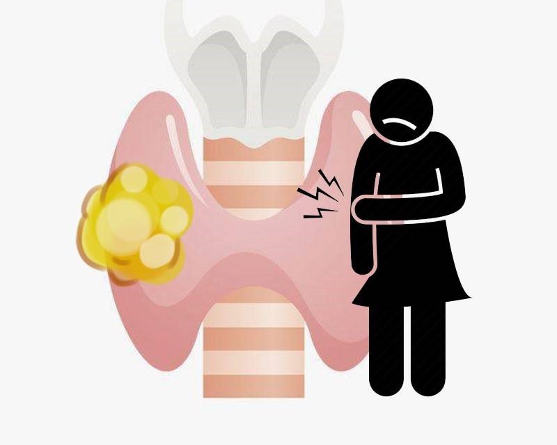 Không phải dưa muối, 4 &#34;thứ&#34; này mới là nguyên nhân gây ra ung thư tuyến giáp - 2