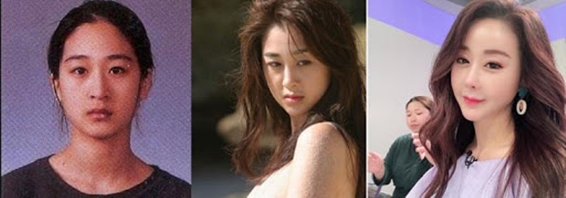Hoa hậu Ham So Won bị ví như phù thủy vì sửa mũi giống người giàu - 4