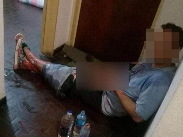 Pháp luật - Qua đêm với nhân tình, chồng bị vợ "xử" luôn “của quý”