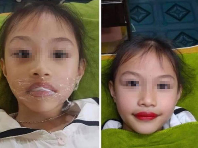Bạn trẻ - Cuộc sống - Xôn xao phụ huynh để con gái 5 tuổi xăm môi đỏ, thợ xăm có hành động "khó đỡ"