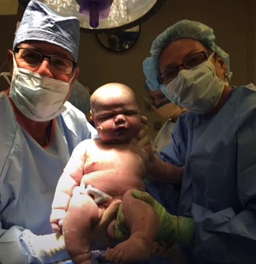 Bà mẹ chia sẻ hình ảnh em bé sau khi vài phút cho thấy cậu con trai to lớn được hai bác sĩ nâng đỡ.