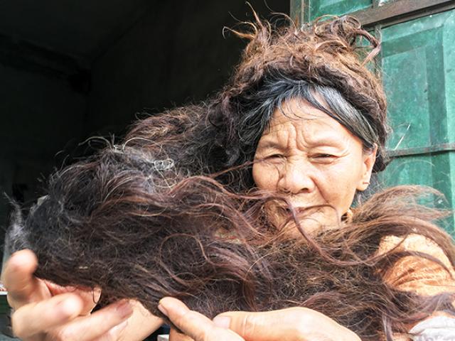 Tin tức trong ngày - Người phụ nữ có mái tóc kì dị: Kết thành nhiều mảng, cứ cắt là đổ bệnh