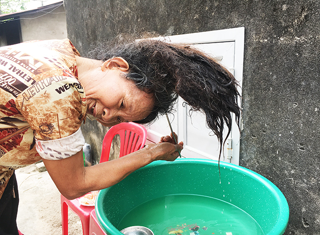 Khi gội đầu, bà Năm phải dùng một que sắt, xiên vào bên trong làm sạch chứ không thể dùng tay gãi.