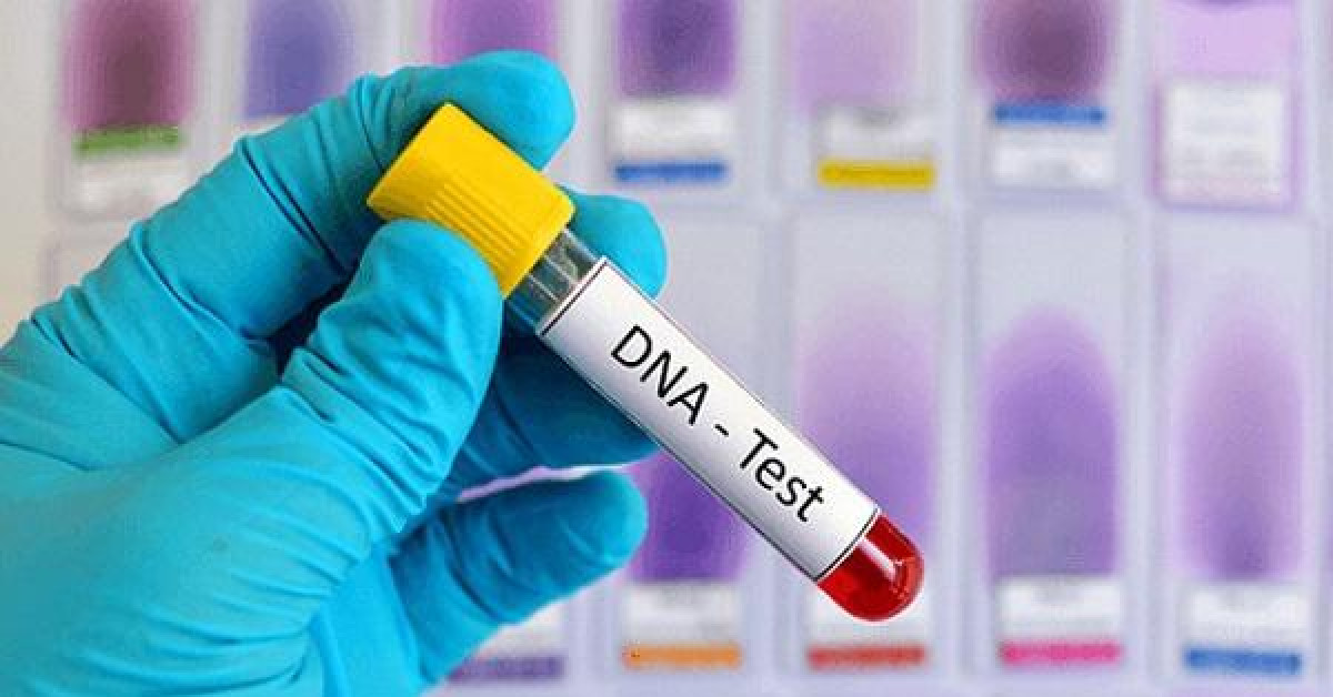 Thế giới - Giấu vợ xét nghiệm ADN với 3 con, người đàn ông “ngã quỵ” trước kết quả phơi bày bí mật đau đớn