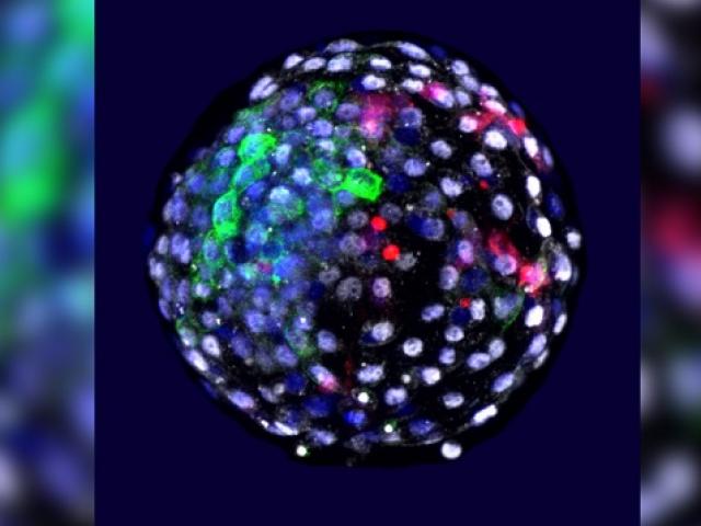 Thế giới - Lần đầu tiên tạo thành công phôi thai lai giữa người và khỉ