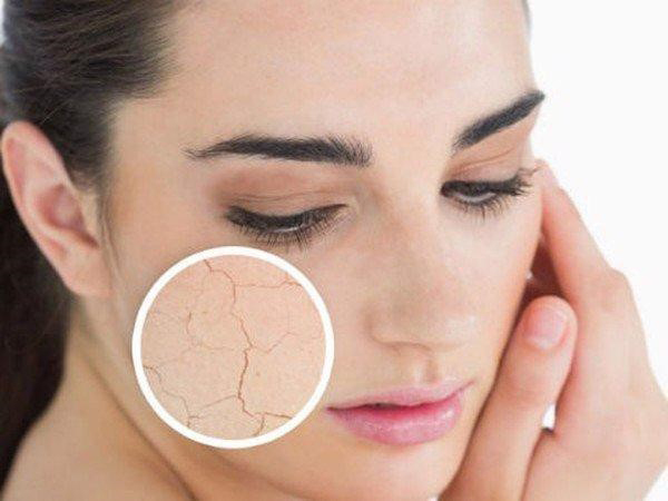 Mỹ phẩm Ricskin - Kohinoor chia sẻ 3 dấu hiệu cho thấy da mặt đang thiếu ẩm trầm trọng - 2