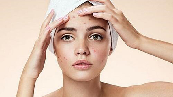 Mỹ phẩm Ricskin - Kohinoor chia sẻ 3 dấu hiệu cho thấy da mặt đang thiếu ẩm trầm trọng - 3