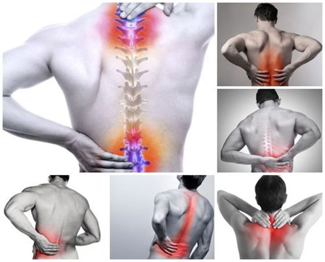 Xẹp đốt sống mà không cần phải mổ chỉ vì nhờ thứ này - 2