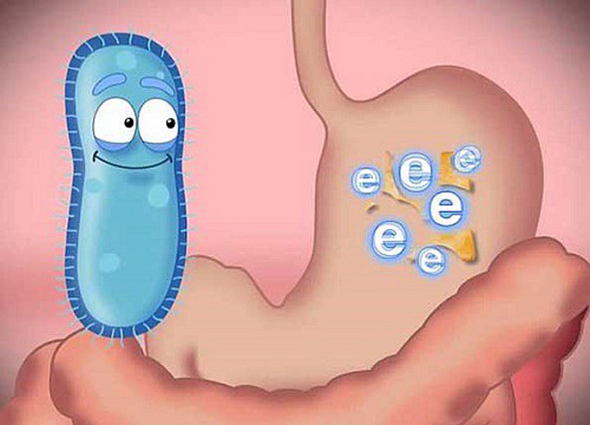 Viêm đại tràng – Nguyên nhân, triệu chứng và cách cải thiện hiệu quả - 3