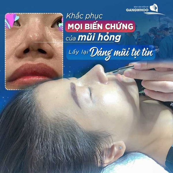 Bác sĩ Phùng Mạnh Cường:&nbsp;“Đôi tay vàng’’ xử lý những ca mũi hỏng