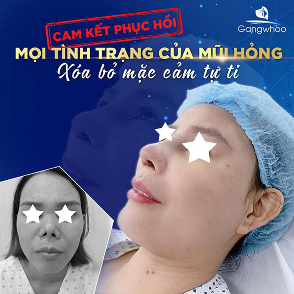 Gặp gỡ vị bác sĩ đã tái tạo thành công hàng ngàn ca mũi hỏng - 2