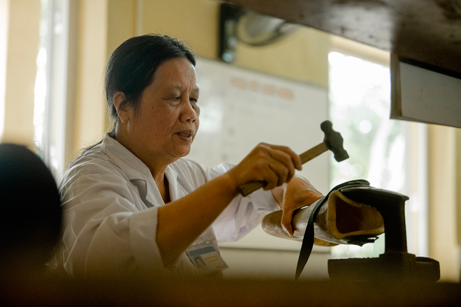 Người đàn bà “điên” dành cả thanh xuân để thương người mắc bệnh chân, tay cụt dần - 4