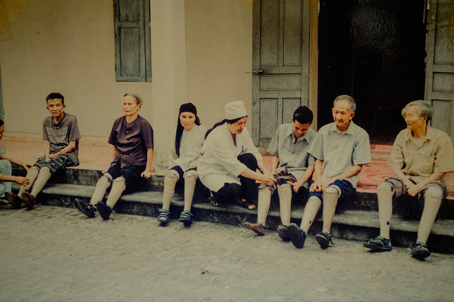 Với những chiếc chân giả, bệnh nhân đi lại dễ dàng hơn