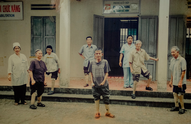 Các bệnh nhân phong người cụt chân, người cụt tay, ngón chân, ngón tay co quắp… khiến bà bàng hoàng, xót thương.