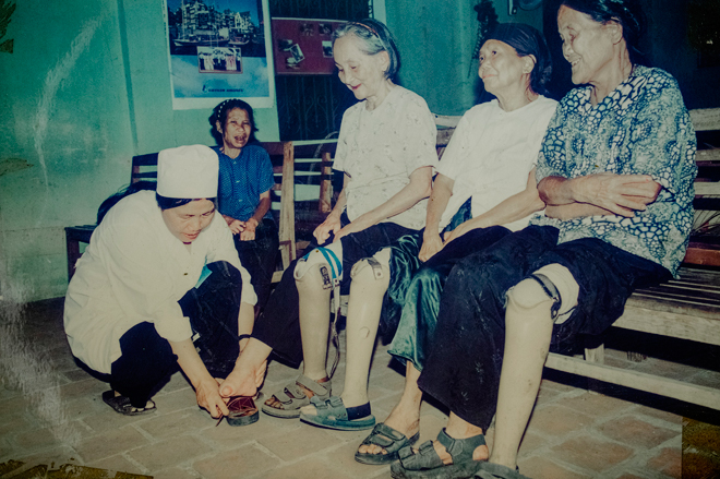 Người mắc bệnh phong có người thì cụt hết ngón chân, để đóng được một đôi dép vừa chân là cả một quá trình gian nan.