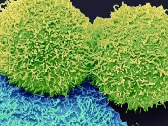 Sức khỏe đời sống - Phát hiện thứ gây ung thư ẩn trong cơ thể người, bấy lâu bị bỏ sót