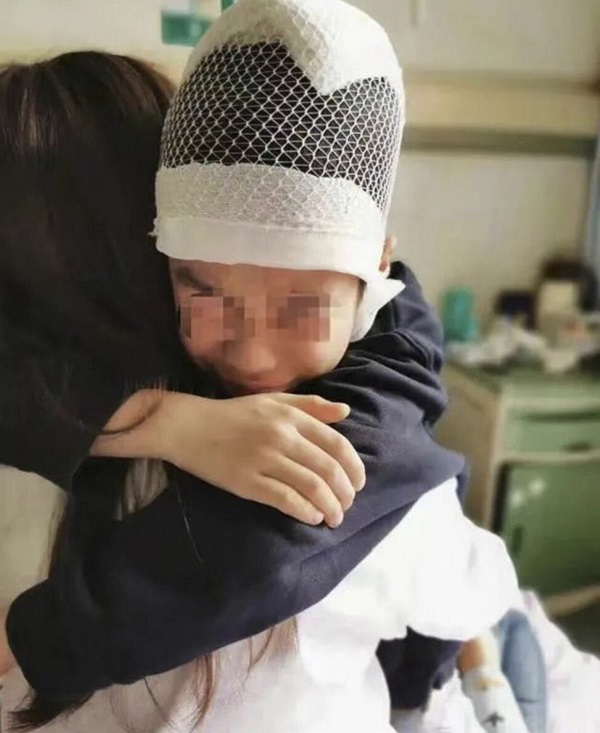 Cậu bé hoảng sợ, bị đau do vết thương mà thầy giáo gây ra. Ảnh: SCMP