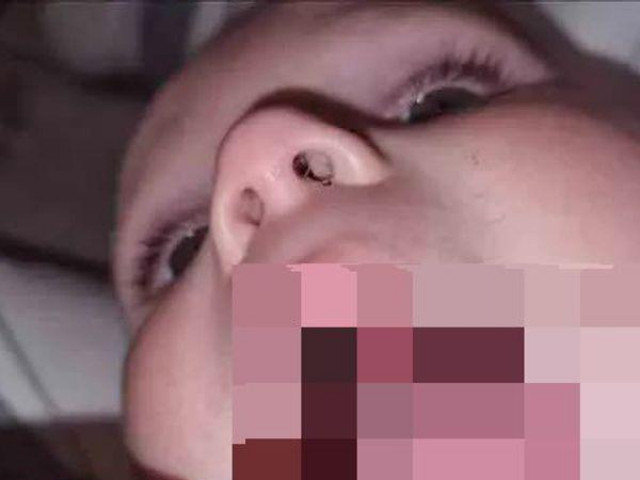 Phi thường - kỳ quặc - Phát hiện lỗ đen trong miệng con, mẹ kinh hãi đưa con đến bệnh viện nhưng lại đem về nỗi xấu hổ