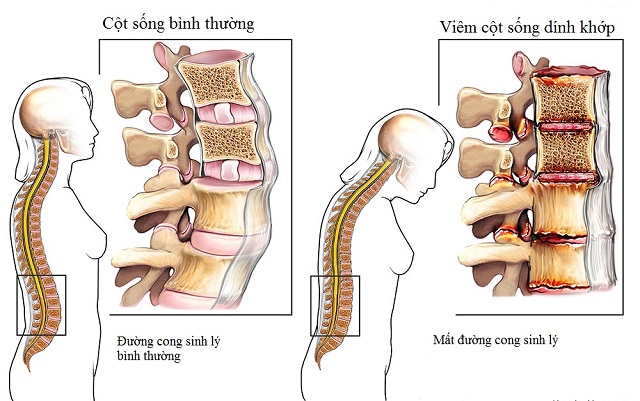 Căn bệnh hiếm gặp khiến “Nam vương châu Á” Châu Kiệt Luân phải khổ sở suốt bao năm - 4