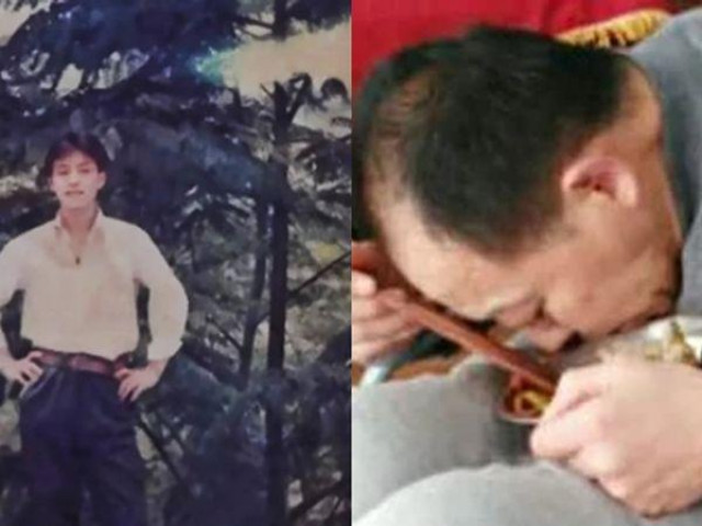 Phi thường - kỳ quặc - Đột ngột mắc bệnh lạ, người đàn ông bị gập đôi người suốt 28 năm và cuộc tái sinh sau phẫu thuật