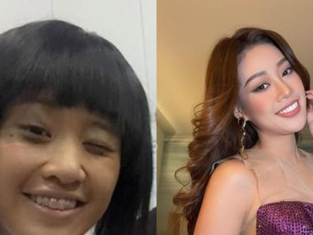 Làm đẹp - Từ Ngọc Hân đến Khánh Vân, những nàng hậu "lột xác" nhờ phép màu mang tên niềng răng