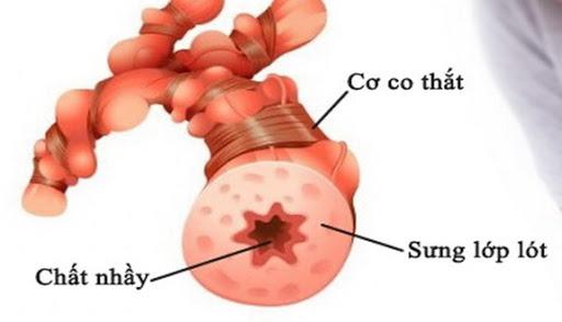 Bí quyết giúp bệnh nhân hen kiểm soát tốt bệnh trong dịch COVID-19 - 1