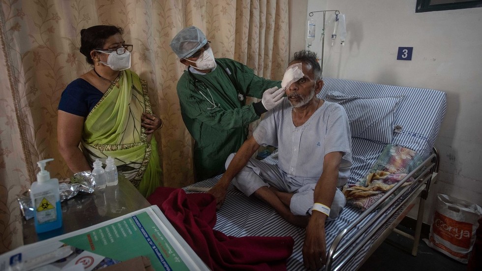Có tới 60% bệnh nhân nhiễm bệnh nấm đen ở Ấn Độ phải cắt bỏ một bên mắt.