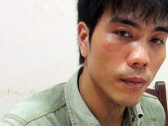 Tin tức trong ngày - Bệnh viện lên tiếng về thông tin "bệnh nhân trốn ra ngoài điều hành đường dây bảo kê"